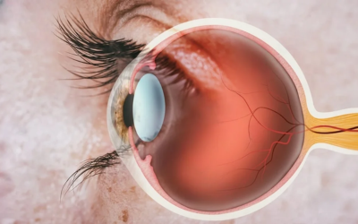 Medical Retina Clinic