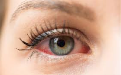 Emergency Eye Care
